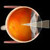 Volk Singh Mid-Vitreous Lens