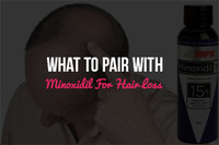 The Hair Issues 15 minoxidil Products Solve Xandrox