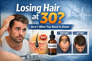 Losing Hair at 30? Here’s What You Need to Know
