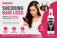 Shedding Hair Loss: When It’s Normal and When It’s Not