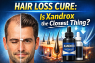 Hair Loss Cure: Is Xandrox the Closest Thing?