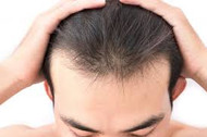 The Ultimate Guide to Combatting Hair Loss