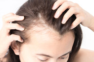 Hair Loss in Women: What Causes It & How to Stop It