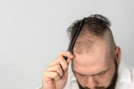 From Shedding to Solutions: What’s Really Causing Your Hair Loss