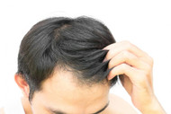 Hair Thinning Remedies: Regain Confidence and Control
