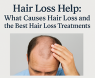 Hair Loss Help: What Causes Hair Loss and the Best Hair Loss Treatment