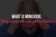 What Is Minoxidil