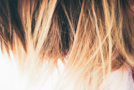 Finding the Best Hair Loss Treatment for Women: A Comprehensive Guide