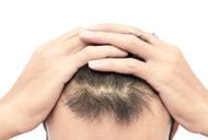 The Best Hair Loss Treatment for Men: Regrow Your Hair with Minoxidil