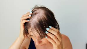 Xandrox The Best Hair Loss Treatment for Women: Achieving Thicker, Fuller Hair ...