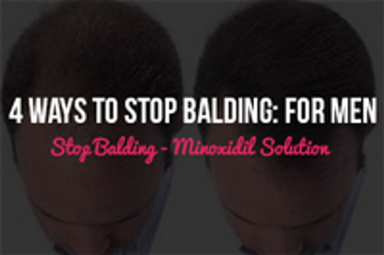 4 Ways to Stop Balding: For Men