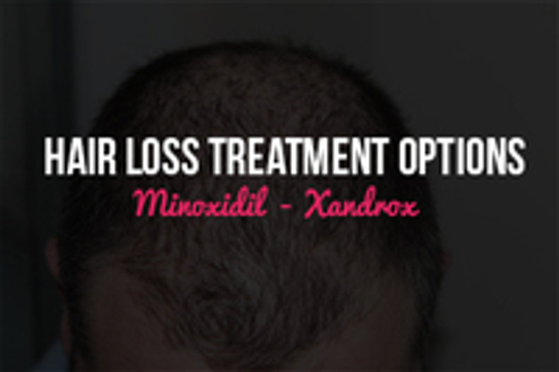 ​Hair Loss Treatment Options