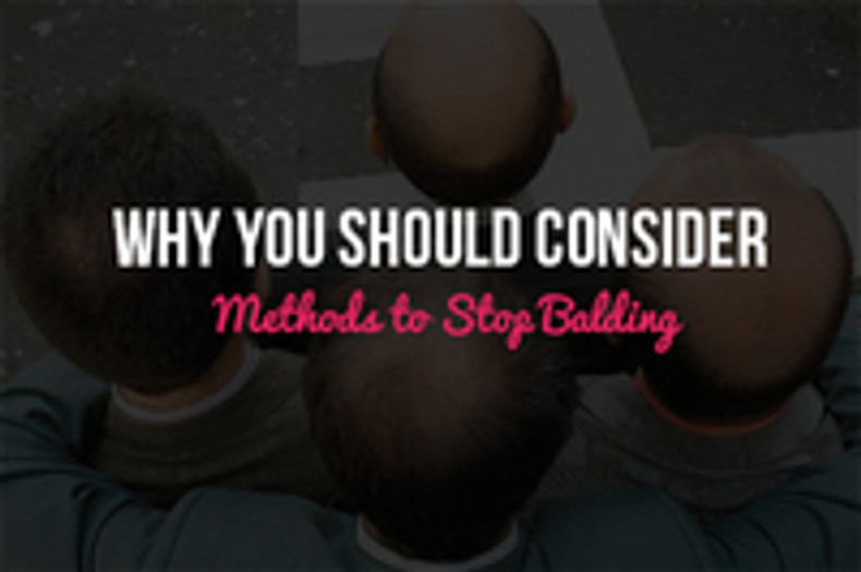 Why You Should Consider Methods to Stop Balding