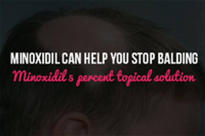 What You Need to Know To Stop Balding