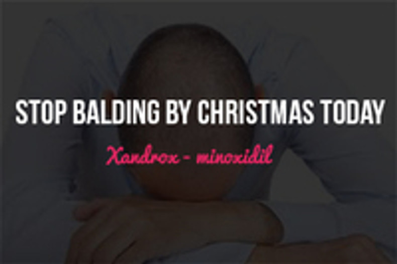 Stop Balding By Christmas Today