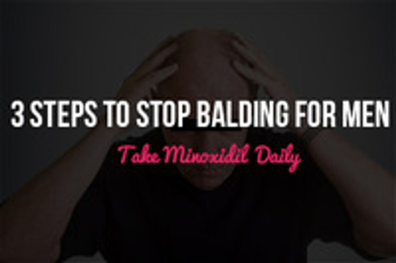 3 Steps to Stop Balding for Men