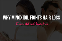 Why Minoxidil Fights Hair Loss