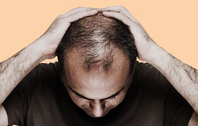 What Can Cause Hair Loss 