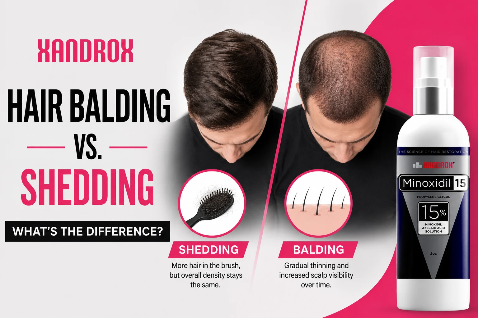 Hair Balding vs. Shedding: What's the Difference?