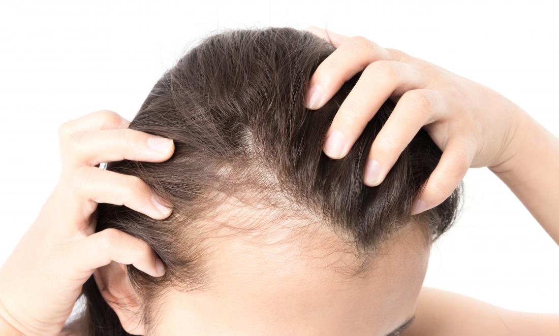 How To Reverse Hair Loss