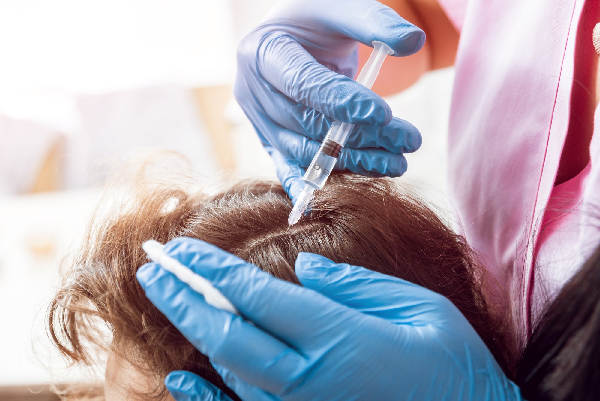 The Ultimate Guide to Hair Loss Treatment: Stop Hair Loss and Regrow Your Hair