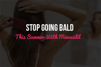 Stop Going Bald This Summer With Minoxidil