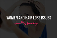 Women and Hair Loss Issues Resulting from Age