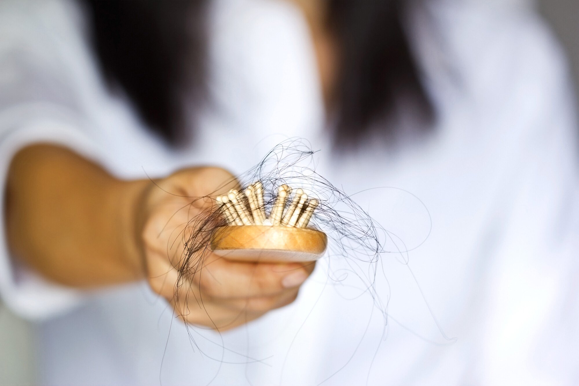 The Ultimate Guide to Regrowing Thinning Hair: Tips and Tricks for Women