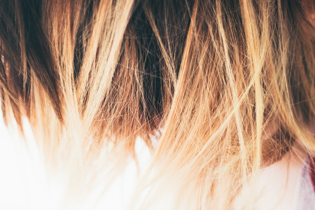 Finding the Best Hair Loss Treatment for Women: A Comprehensive Guide