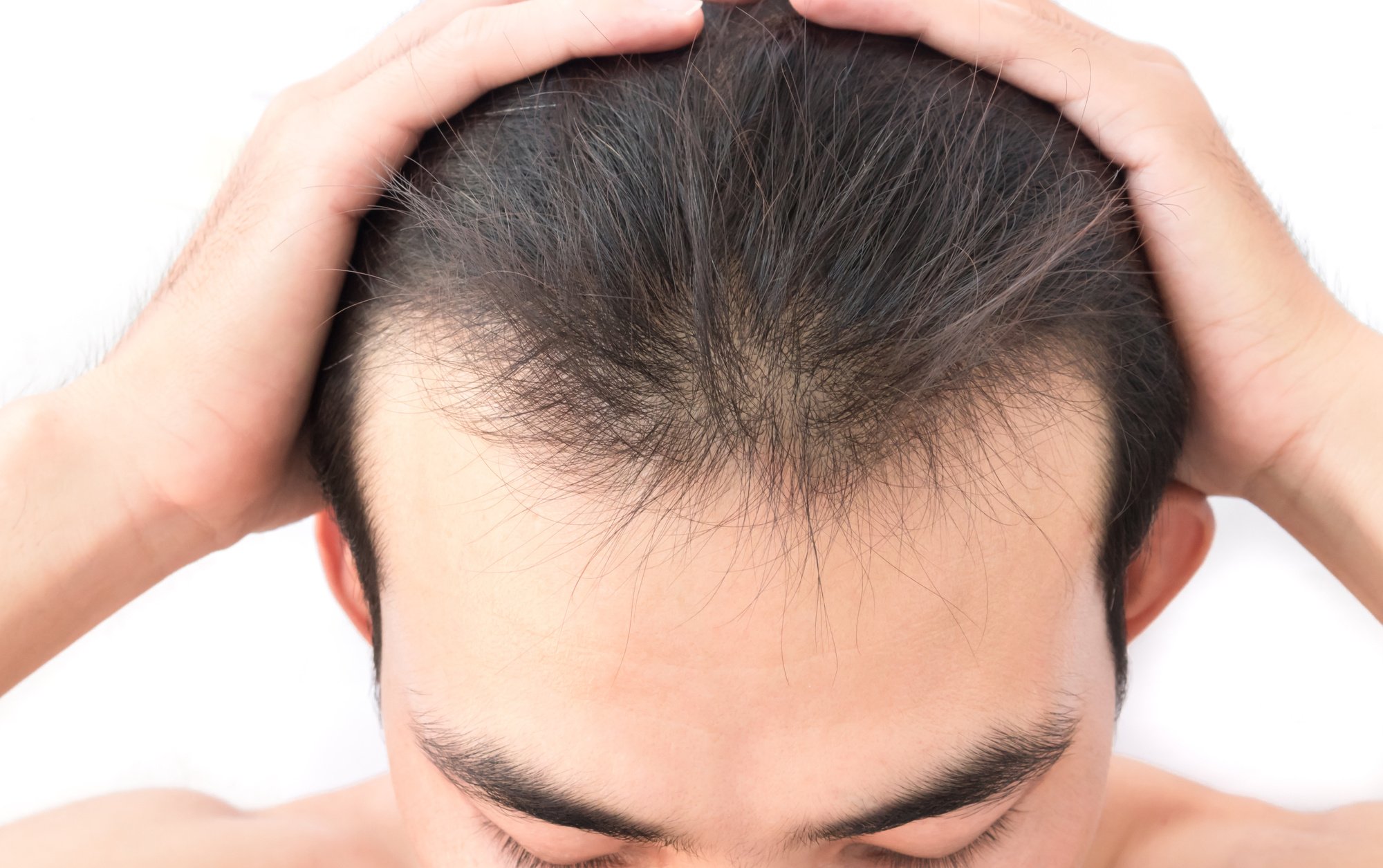 How to Regrow Hair: Tips and Products for Men