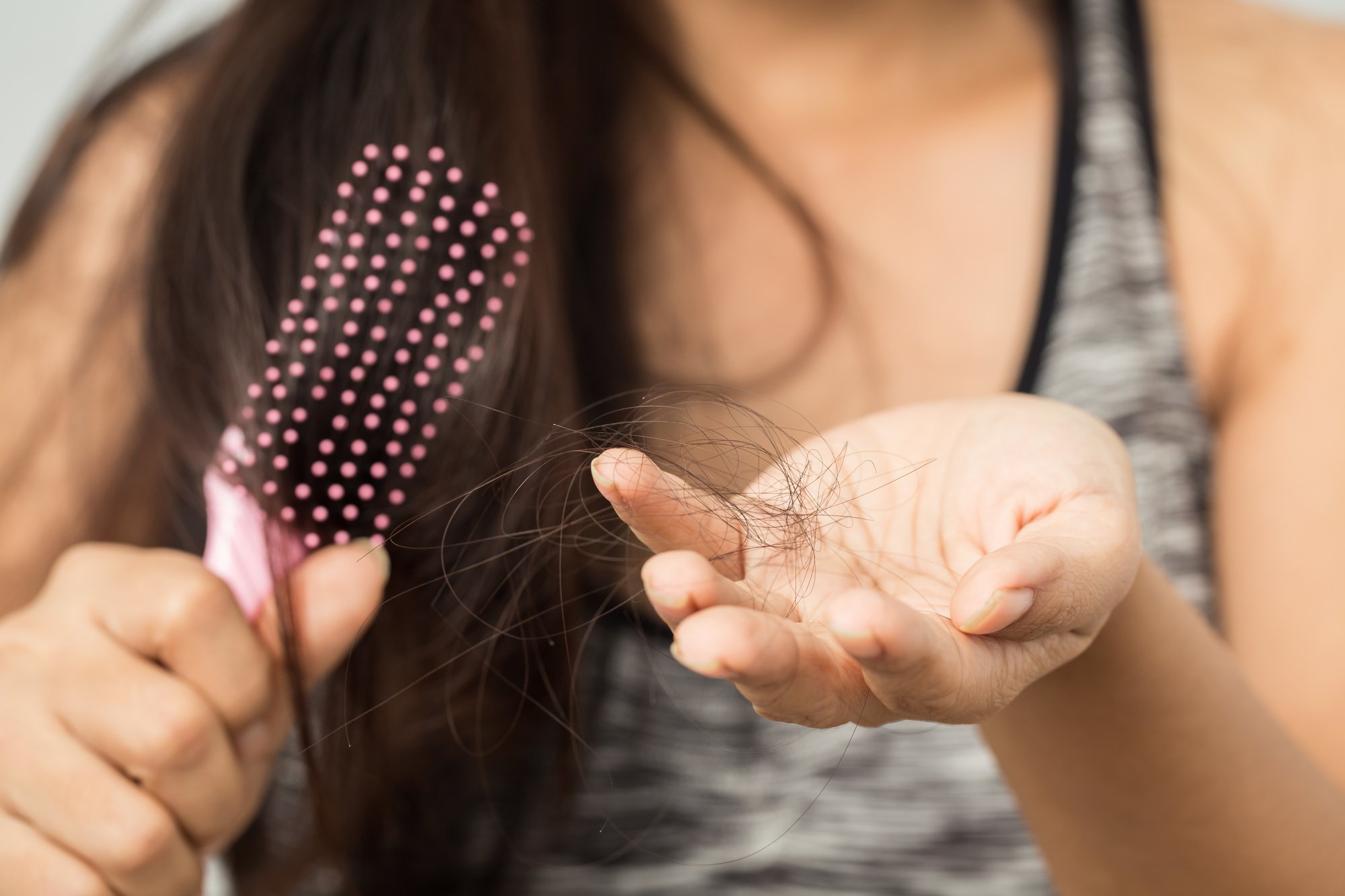 The Best Hair Loss Treatment for Females: How to Regrow and Thicken Thinning Hair