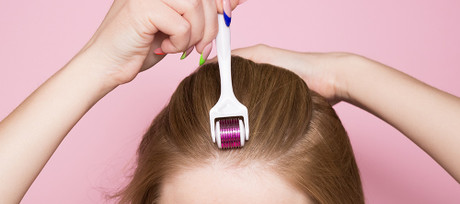 FAQs on Microneedling for Hair Loss