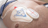 ZOLL R Series ALS Monitor Defibrillator with See-Thru CPR, OneStep Electrodes and Real CPR Help Feedback