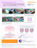 Smith & Nephew ALLEVYN COMPLETE CARE Silicone Foam Dressing – 11 Configurations – Sizes 3" x 3" to 6.7" x 6.8"