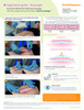 Smith & Nephew ALLEVYN COMPLETE CARE Silicone Foam Dressing – 11 Configurations – Sizes 3" x 3" to 6.7" x 6.8"