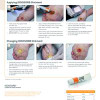 Smith & Nephew IODOSORB Cadexomer Iodine Wound Gel – 2 Configurations – Sold as 4/bx, 12bx/cs