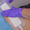 Smith & Nephew PICO PHMB Gauze Filler NPWT Antimicrobial – Single Configuration – Size 6"x 6¾"
