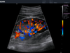 Edan Acclarix AX8 Diagnostic Ultrasound System – Acclarix AX8 Diagnostic Ultrasound System