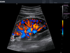 Edan Acclarix AX8 Diagnostic Ultrasound System – Acclarix AX8 Diagnostic Ultrasound System