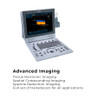 Edan U50 and U60 Ultrasound Transducers – Linear Array Transducer Probe, Professional Diagnostic Equipment