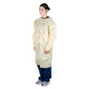Dukal AAMI Level 2 Isolation Gown – Over-the-Head Design, Elastic Wrist with Thumb Loop, XL, Yellow, SMS