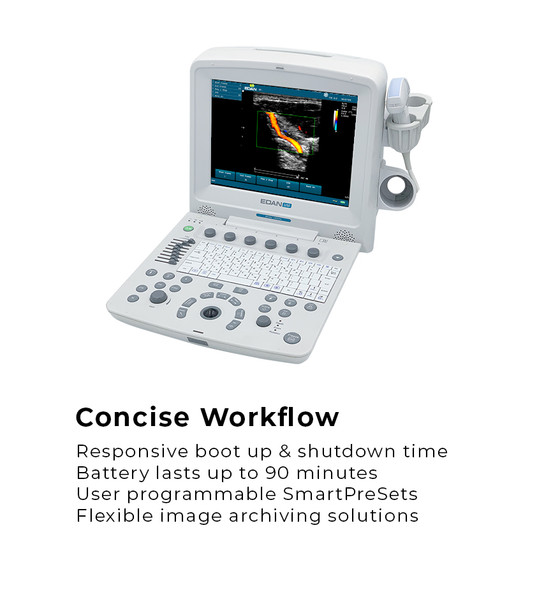 Edan U50 Diagnostic Ultrasound System – Ultrasound System, Professional Diagnostic Equipment