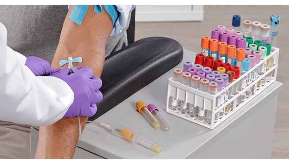 BD Vacutainer Specialty Tubes – Silicone Coated K3edta, Glass, 10 mL and 7 mL Draw Volumes