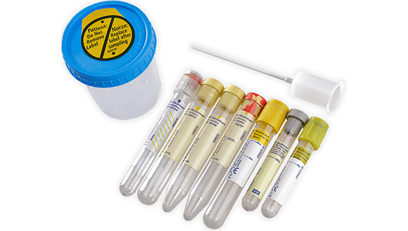 BD Vacutainer Plus Plastic Round-Bottom Tube for Urinalysis – 16 x 100 mm, 10.0 mL, Conventional Yellow