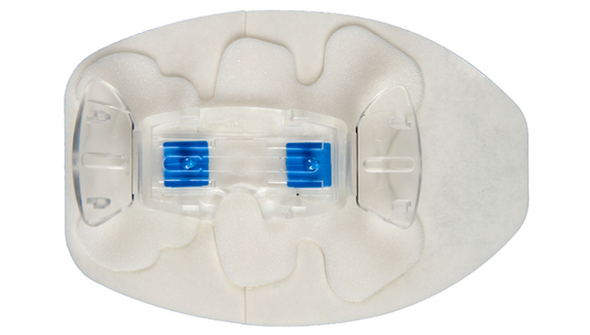 BD Statlock PICC Plus Pediatric Sliding Post Foam – Pediatric IV Stabilization Device, Sliding Post Design