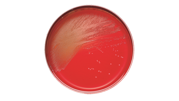 BD BBL Columbia CNA Agar with 5% Sheep Blood Plate – 100 Plates, 84-Day Shelf Life, Prepared Culture Media