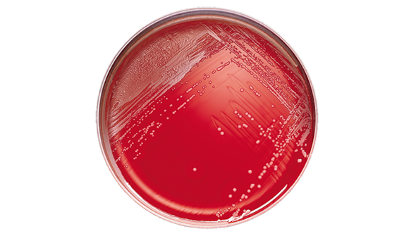 BD BBL Phenylethyl Alcohol Agar Plate with 5% Sheep Blood – Selective Medium, 84-Day Shelf Life
