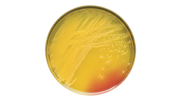 BD BBL Mannitol Salt Agar Plate – Selective Isolation Medium, 100 Plates per Pack, 98-Day Shelf Life