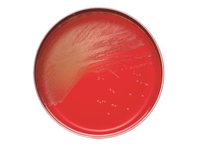BD BBL Columbia CNA Agar with 5% Sheep Blood Plate – 20 Plates per Pack, 84-Day Shelf Life