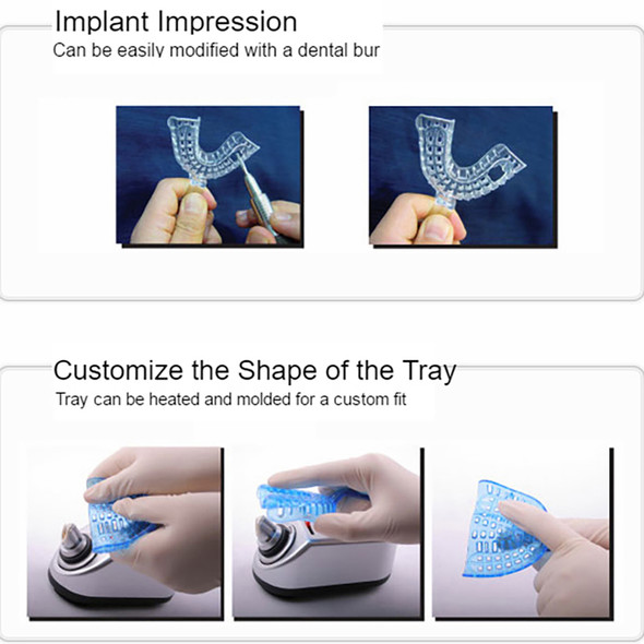 Dukal Impression Perforated Impression Tray – Anterior Upper, Pink, 12/BG, 10 BGs/CS, 4 lb